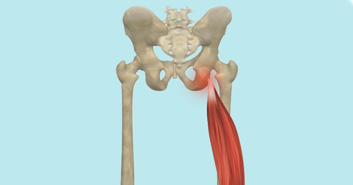 Sit Bone Pain Has More Than One Cause - Updated 2021 - Yoga Anatomy